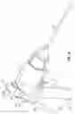 Fig. 02 - STEERABLE CATHETER SYSTEM