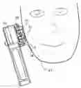 Fig. 01 - Acne treatment device