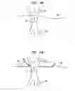 Fig. 12 - Methods And Devices For Fractional Ablation Of Tissue