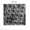 Fig. 34 - Methods And Devices For Fractional Ablation Of Tissue