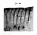 Fig. 36 - Methods And Devices For Fractional Ablation Of Tissue
