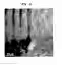 Fig. 37 - Methods And Devices For Fractional Ablation Of Tissue