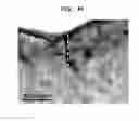 Fig. 44 - Methods And Devices For Fractional Ablation Of Tissue