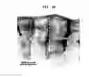 Fig. 45 - Methods And Devices For Fractional Ablation Of Tissue