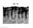 Fig. 46 - Methods And Devices For Fractional Ablation Of Tissue