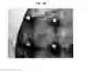 Fig. 56 - Methods And Devices For Fractional Ablation Of Tissue