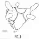 Fig. 02 - System and Method For Electrophysiology Regaining Support to Continue Line and Ring Ablations