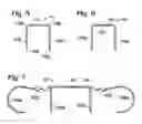 Fig. 04 - Connective tissue repair system