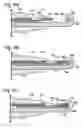 Fig. 05 - Connective tissue repair system