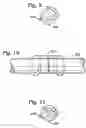 Fig. 06 - Connective tissue repair system