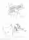 Fig. 02 - ORTHOPEDIC DEVICE FOR SECURING TO TISSUE