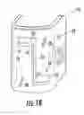 Fig. 03 - System and method for bone shortening