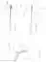 Fig. 23 - SPINE DISTRACTION IMPLANT AND METHOD