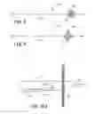 Fig. 04 - Embolectomy procedures with a device comprising a polymer and devices with polymer matrices and supports