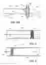 Fig. 05 - Embolectomy procedures with a device comprising a polymer and devices with polymer matrices and supports