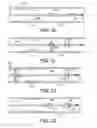 Fig. 09 - Embolectomy procedures with a device comprising a polymer and devices with polymer matrices and supports