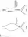 Fig. 07 - Active blood vessel sleeve