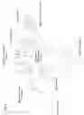 Fig. 10 - Active blood vessel sleeve