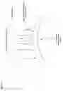 Fig. 12 - Active blood vessel sleeve