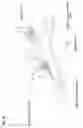 Fig. 57 - Active blood vessel sleeve