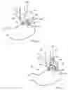 Fig. 03 - Transesophageal gastric reduction method and device for practicing same