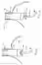Fig. 06 - Transesophageal gastric reduction method and device for practicing same