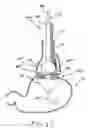 Fig. 10 - Transesophageal gastric reduction method and device for practicing same
