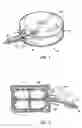 Fig. 02 - Devices and methods using an expandable body with internal restraint for compressing cancellous bone