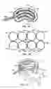 Fig. 06 - Devices and methods using an expandable body with internal restraint for compressing cancellous bone