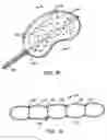 Fig. 07 - Devices and methods using an expandable body with internal restraint for compressing cancellous bone