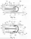 Fig. 02 - In vivo filter assembly