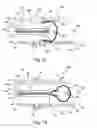 Fig. 03 - In vivo filter assembly