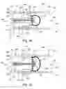 Fig. 04 - In vivo filter assembly