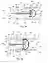 Fig. 06 - In vivo filter assembly