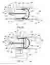 Fig. 07 - In vivo filter assembly