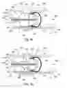 Fig. 09 - In vivo filter assembly
