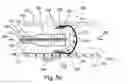 Fig. 10 - In vivo filter assembly