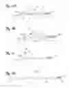 Fig. 02 - Convertible embolic protection devices and methods of use