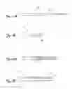 Fig. 03 - Convertible embolic protection devices and methods of use