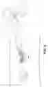 Fig. 05 - Elliptical Excision Clamp