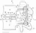 Fig. 01 - Spinal prosthesis systems