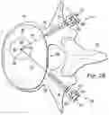 Fig. 04 - Spinal prosthesis systems