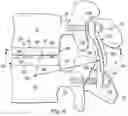 Fig. 08 - Spinal prosthesis systems