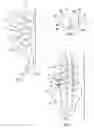 Fig. 02 - Spinal Stabilization System