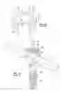 Fig. 04 - Spinal fixation device