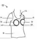 Fig. 01 - Breast exposed under garment