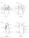 Fig. 02 - Breast exposed under garment