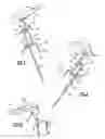 Fig. 02 - Surgical support for patient limb