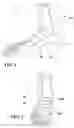 Fig. 02 - Skate boot