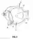 Fig. 06 - Interlock vessel for hyperbaric transfer system
